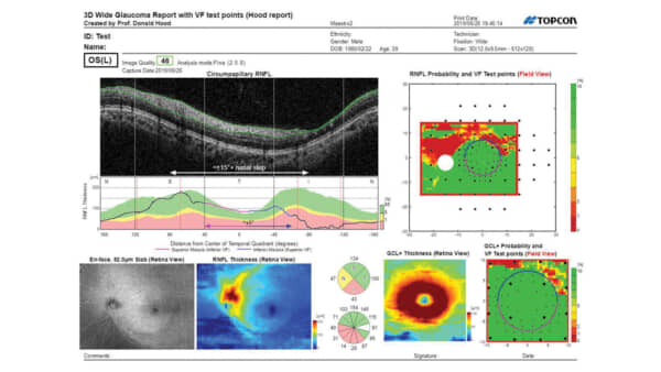 Maestro 2 Hood Report